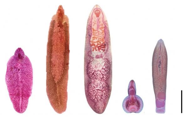 식물매개 흡충류 현미경 사진. 왼쪽부터 간질, 거대간질, 비대흡충, 인위반충, Fischoederius elongatus(scale=5mm). ⓒ의협신문