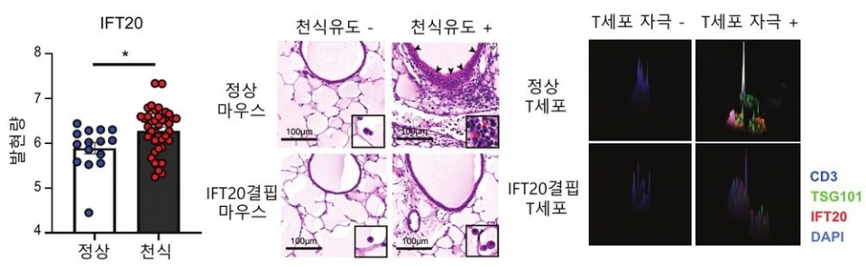 ■ 정상인에 비해서 천식환자에게서 혈액내의 IFT20발현량이 증가되어 있다. T세포에 국한돼 IFT20이 결핍된 마우스는 정상마우스에 비해 천식유도가 잘 되지 않는다. IFT20이 결핍된 T세포는 정상 T세포에 비해 면역학적 시냅스 형성이 잘 되지 않는다.