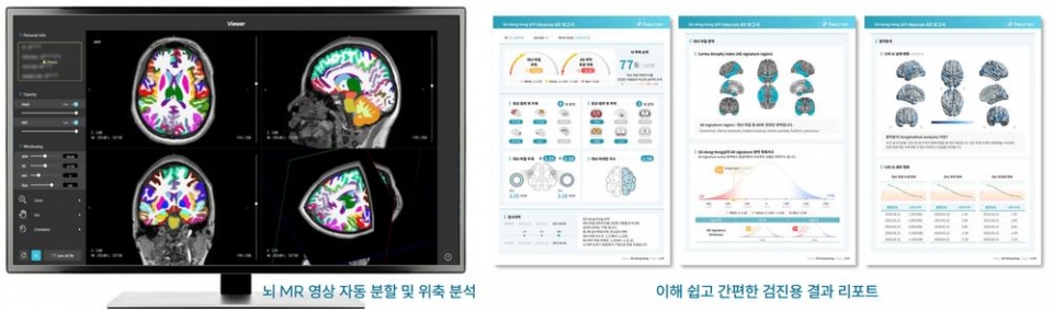 가천대 길병원 VIP건강증진센터가 인공지능을 이용한 파킨슨·치매 건강검진 프로그램을 도입했다. 뇌MRI 검사로 파킨슨 여부를 가늠하고, 알츠하이머 진단을 위한 뇌 위축도를 확인할 수 있는 게 특징이다. 사진은 뇌 MRI 영상검사 자료와  결과 분석지 견본.