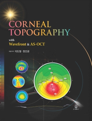 [CORNEAL TOPOGRAPHY with Wavefront & AS-OCT](각막형태검사) ⓒ의협신문
