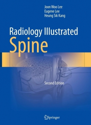 [Radiology Illustrated: Spine] 2판 ⓒ의협신문