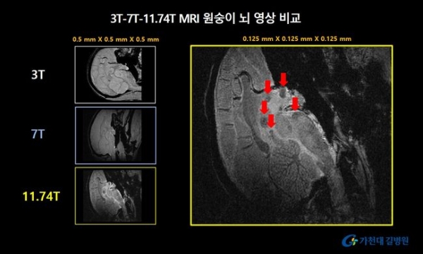 ■ 원숭이 뇌 영상 비교. 11.74T MRI를 이용해 해상도를 0.125mm까지 높인 영상에서는 기존 MRI 영상에서는 확인하기 어렵던 세포핵(화살표 표기)을 더욱 선명하게 확인할 수 있다.