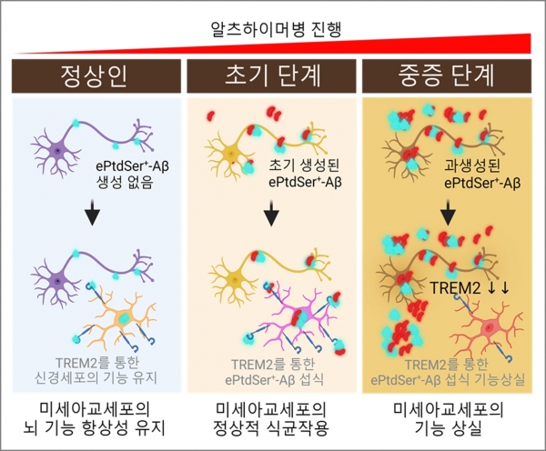 알츠하이머병(AD) 진행 중 외부화된 포스파티딜세린(ePtdSer)과 베타 아밀로이드(Aβ) 플라크에 대한 미세아교세포의 활동과 TREM2 발현 변화를 나타낸다. 초기 알츠하이머병 단계(왼쪽)의 손상된 뉴런은 표면에 외부화된 포스파티딜(ePtdSer) 양성 Aβ플라크를 방출한다. TREM2 발현이 증가한 미세아교세포는 ePtdSer 양성 Aβ 플라크를 인식하고 식균작용을 통해 제거한다. 진행된 알츠하이머병 단계(오른쪽)의 알츠하이머병이 진행됨에 따라 ePtdSer 양성 Aβ 플라크의 양이 현저히 증가한다. 그러나 TREM2 발현이 감소한 미세아교세포는 ePtdSer 양성 Aβ 플라크를 효과적으로 제거하지 못한다. 종합적으로 TREM2의 발현 수준이 알츠하이머병 진행에 따라 미세아교세포의 식균작용 능력에 중요한 영향을 미친다는 것을 시사한다. 초기 단계에서는 TREM2가 높은 미세아교세포가 ePtdSer 양성 Aβ 플라크를 잘 제거하지만, 알츠하이머병이 진행됨에 따라 TREM2 발현이 감소해 식균작용 효율이 떨어진다. [그래픽=서울대학교의과대학] ⓒ의협신문