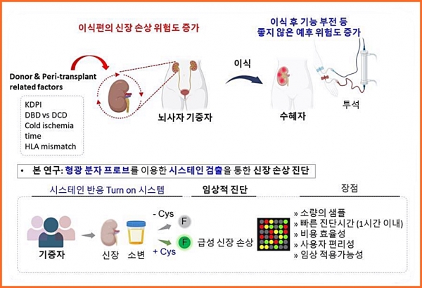 시스테인 수치를 감지하는 형광 분자 프로브(NPO)를 활용한 신장 손상 진단 모식도. ⓒ의협신문